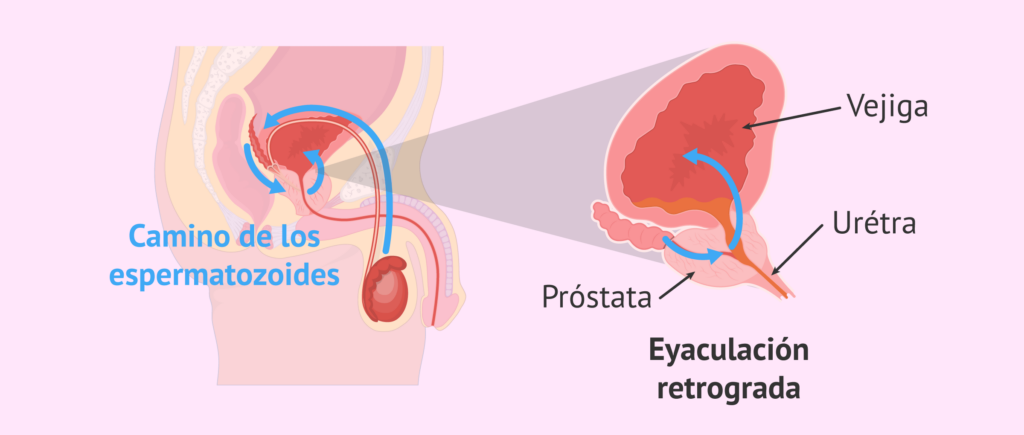 proceso-eyaculación-retrógrada-1-1024x435.png