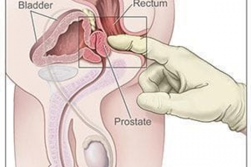 Comment trouver la prostate ?